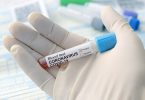 coronavirus covid19 immunity test